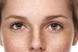 脸上斑斑点点很难看 都是什么原因导致我们脸上长斑