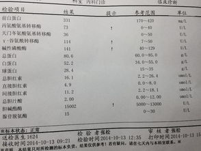 肝病 转氨酶高说明什么 