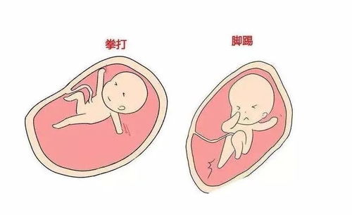 胎动与男孩女孩有关