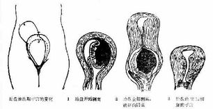 2013临床执业医师妇产科辅导资料 第三产程临床经过及处理 