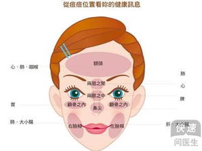 结节痤疮怎么排出来 三大方法很实用