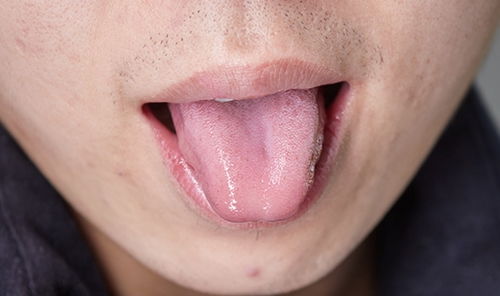 身体好不好,伸出舌头看看,教你如何从舌头变化发现大病征兆