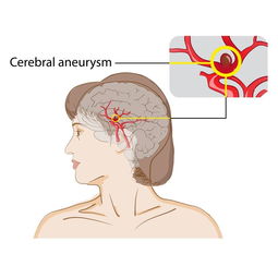 神奇 妈妈死后3个月竟生下儿子 每个人看完都哭了...