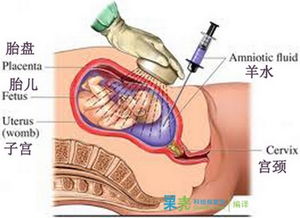 为什么要做唐氏筛查 2 