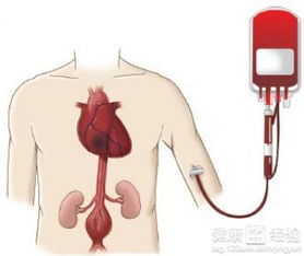 输血原则的输血方式 