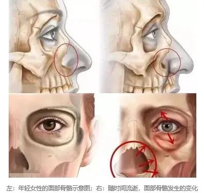 倍她液态骨雕 骨骼清奇 的你不仅好看,还很耐老哦