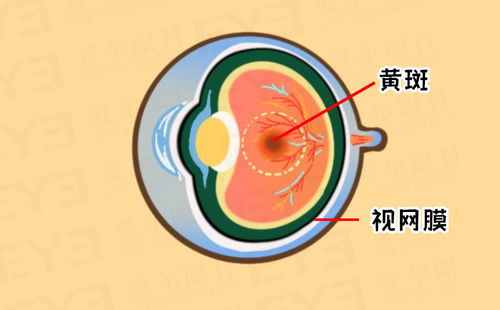 一图自测 你是否有致盲眼病