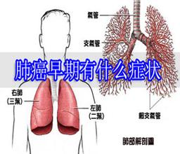 肺癌早期背痛位置图片 信息评鉴中心 酷米资讯 Kumizx Com