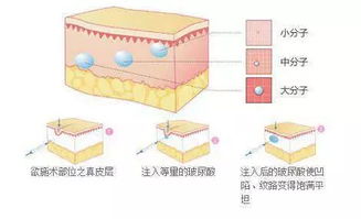 玻尿酸的作用与危害 玻尿酸的作用与危害分别是什么