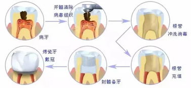 牙医的心里话 说给口腔疾病患者的15句建议