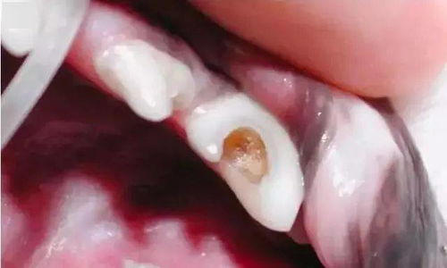 狗狗牙齿疾病的严重性