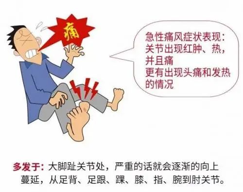 特殊时期痛风急性发作时,怎么办