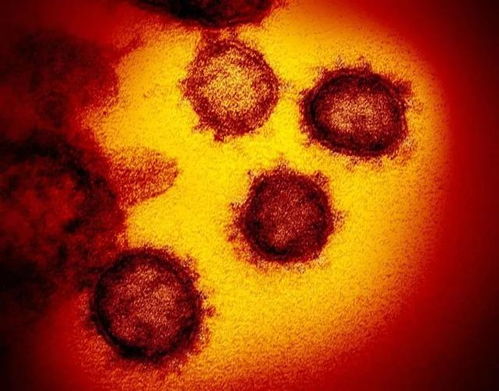 新冠病毒为什么不能叫 中国病毒