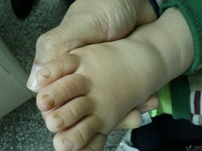 1岁半的小孩的脚趾甲,希望大家给建议和方向