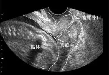 独家解析 人孕她孕,为何偏偏徐若瑄会如此艰辛