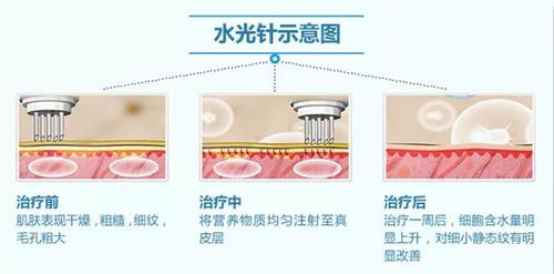 夏天满脸都是汗,为什么还要补水