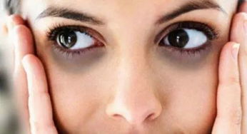 黑眼圈可能暗示4种疾病,几招帮你消除眼袋 黑眼圈,快学起来 