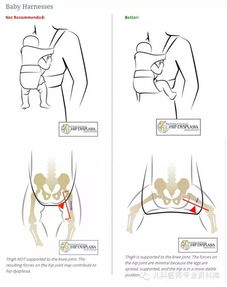 婴儿绑腿是好是坏 如何包裹孩子