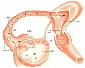 多囊卵巢综合征患者的促排卵治疗