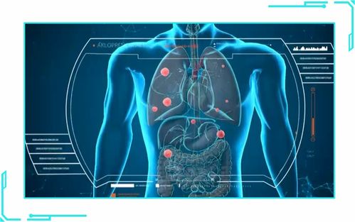 这三种前沿医疗方法,竟可以把肺癌变成 慢性病