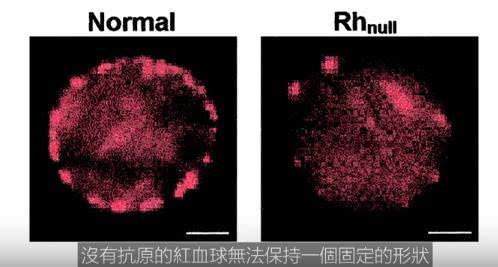 世上最罕见血型 黄金血液 全世界只有43人拥有 极度珍贵