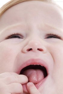 宝宝口腔溃疡怎么办 小儿口腔溃疡怎么办