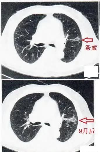 肺好不好,有哪些症状表现