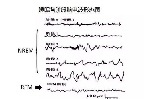 为什么在睡觉时,我们经常做各种各样的梦 它有什么深层的意义