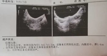 两个月没来月经，两个月没来月经是什么原因