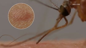 疟疾是如何通过蚊子传播的