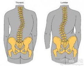 26个月的宝宝被查出先天性脊柱侧弯，是必须进行手术吗(婴儿先天性脊柱侧弯)