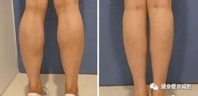 女生小腿肌肉特别结实,怎样才能瘦小腿