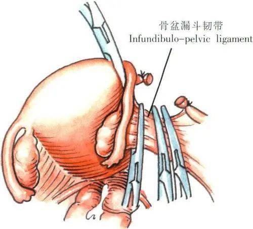 子宫切除对身体有什么影响