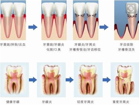 年龄大了就不能箍牙了吗