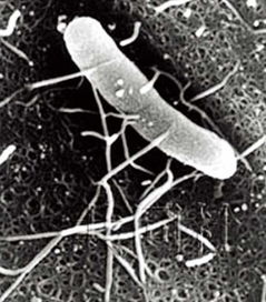 超级细菌是一种怎么的病毒