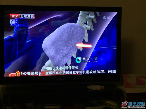 北京卫视 一个小孩身上12根钢针之谜