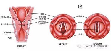 耳鼻喉都有哪些高发疾病