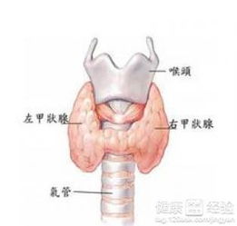 亚急性甲状腺炎的检查项目有哪些