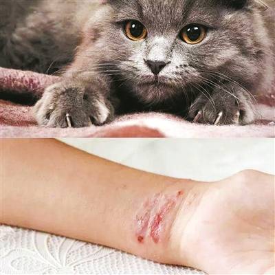 猫抓病 可非小事, 小心为健康埋下隐患