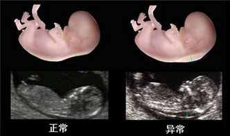 原创怀孕20周，胎宝宝最怕这3种声音，不仅伤害听力，也影响智力发育