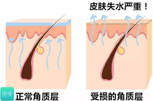 无痛的无针水光和有点痛的水光针到底有啥区别呢 水光针用户真实体验 