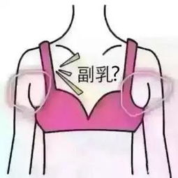 什么叫乳腺未完全发育