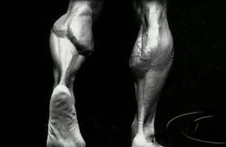 女性小腿肌肉形状能改变吗