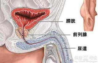 前列腺炎疾病的诱发原因有什么