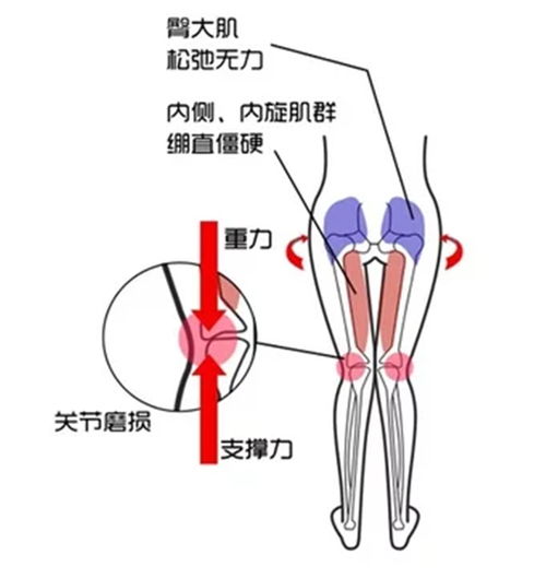 假胯宽腿粗屁股大 是臀部肌肉在捣鬼,3个方法让你又窄又瘦