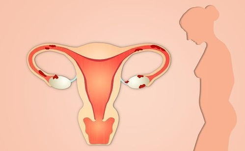 女人最晚几岁还能要孩子 到了停止排卵的年龄,怀孕可能有些困难