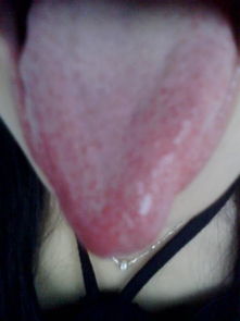 看看我的舌头颜色有点白白的,不痛不痒没啥感觉的,正常吗