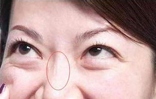 鼻子皱纹运势(鼻子的皱纹叫什么纹)(鼻子的运势是什么岁数)