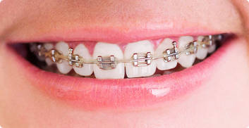 牙齿矫正期间是否可以换医生(矫正牙齿过程中可以换医生吗)
