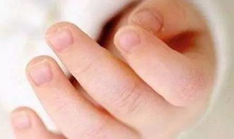 指甲上的月牙 竖纹 小白点说明缺什么 权威儿科专家这样说 